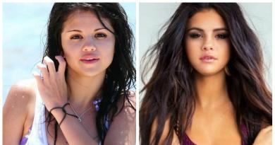 Tähdet ennen ja jälkeen plastiikkaleikkauksen Onko Selena Gomez käynyt plastiikkaleikkauksen?