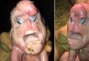 मलेशियाई एक मानव चेहरे के साथ एक बच्चा पैदा हुआ था